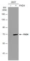 Peptidyl Arginine Deiminase 4 antibody, GTX113946, GeneTex, Western Blot image 