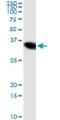 Nicotinamide N-Methyltransferase antibody, H00004837-M03, Novus Biologicals, Immunoprecipitation image 