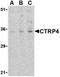 C1q And TNF Related 4 antibody, orb74636, Biorbyt, Western Blot image 