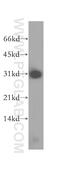 Proteasome Activator Subunit 2 antibody, 12937-2-AP, Proteintech Group, Western Blot image 