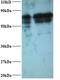 Inosine Monophosphate Dehydrogenase 2 antibody, LS-C211100, Lifespan Biosciences, Western Blot image 