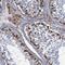 Phosphoglucomutase 2 antibody, PA5-59247, Invitrogen Antibodies, Immunohistochemistry paraffin image 