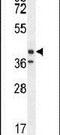 Tectorin Beta antibody, PA5-23785, Invitrogen Antibodies, Western Blot image 