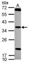 Testis Specific Serine Kinase 4 antibody, LS-C155480, Lifespan Biosciences, Western Blot image 