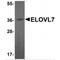 Elongation of very long chain fatty acids protein 7 antibody, MBS151099, MyBioSource, Western Blot image 