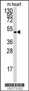 Protein Kinase AMP-Activated Non-Catalytic Subunit Gamma 1 antibody, MBS9208509, MyBioSource, Western Blot image 