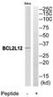 BCL2 Like 12 antibody, MBS004764, MyBioSource, Western Blot image 