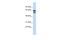 Polypeptide N-Acetylgalactosaminyltransferase 4 antibody, A11857, Boster Biological Technology, Western Blot image 