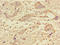 Protein Phosphatase 1 Catalytic Subunit Gamma antibody, A63202-100, Epigentek, Immunohistochemistry paraffin image 