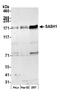 SAM And SH3 Domain Containing 1 antibody, A302-265A, Bethyl Labs, Western Blot image 