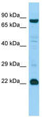 Mediator Complex Subunit 22 antibody, TA331270, Origene, Western Blot image 