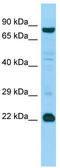 Mediator Complex Subunit 22 antibody, TA331270, Origene, Western Blot image 