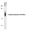 Dopamine Beta-Hydroxylase antibody, PPS067, R&D Systems, Western Blot image 