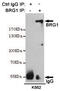 SWI/SNF Related, Matrix Associated, Actin Dependent Regulator Of Chromatin, Subfamily A, Member 4 antibody, GTX16472, GeneTex, Immunoprecipitation image 