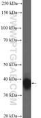 Homeobox B4 antibody, 22256-1-AP, Proteintech Group, Western Blot image 