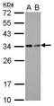 Toll Interacting Protein antibody, GTX116566, GeneTex, Western Blot image 