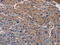 NADH:Ubiquinone Oxidoreductase Subunit A9 antibody, CSB-PA289822, Cusabio, Immunohistochemistry paraffin image 