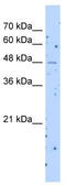 Solute Carrier Family 22 Member 23 antibody, TA338479, Origene, Western Blot image 