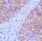 Arginase 1 antibody, PA5-32267, Invitrogen Antibodies, Immunohistochemistry paraffin image 