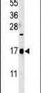 Stum, Mechanosensory Transduction Mediator Homolog antibody, PA5-25426, Invitrogen Antibodies, Western Blot image 