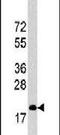 Cyclin Dependent Kinase Inhibitor 1B antibody, PA5-13254, Invitrogen Antibodies, Western Blot image 