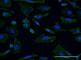 SH3 Domain Containing GRB2 Like 1, Endophilin A2 antibody, H00006455-M01, Novus Biologicals, Immunofluorescence image 