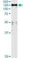 Minichromosome Maintenance Complex Component 2 antibody, LS-C197660, Lifespan Biosciences, Immunoprecipitation image 