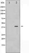 Protein Kinase AMP-Activated Non-Catalytic Subunit Beta 1 antibody, TA326021, Origene, Western Blot image 