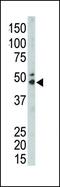 Sphingosine Kinase 1 antibody, PA5-14068, Invitrogen Antibodies, Western Blot image 