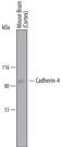 Cadherin 4 antibody, AF6677, R&D Systems, Western Blot image 
