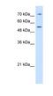 Lipopolysaccharide Binding Protein antibody, NBP1-58972, Novus Biologicals, Western Blot image 