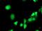 Eukaryotic Translation Initiation Factor 2B Subunit Gamma antibody, NBP2-01370, Novus Biologicals, Immunocytochemistry image 
