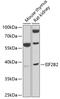 Eukaryotic Translation Initiation Factor 2B Subunit Beta antibody, 22-641, ProSci, Western Blot image 