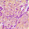 Zinc Binding Alcohol Dehydrogenase Domain Containing 2 antibody, LS-C353670, Lifespan Biosciences, Immunohistochemistry paraffin image 