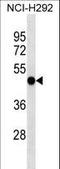 Eukaryotic Translation Initiation Factor 2 Subunit Gamma antibody, LS-C159518, Lifespan Biosciences, Western Blot image 