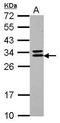 CCR4-NOT Transcription Complex Subunit 7 antibody, GTX118241, GeneTex, Western Blot image 