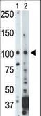 NIMA Related Kinase 9 antibody, LS-C101171, Lifespan Biosciences, Western Blot image 