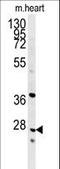 Indolethylamine N-Methyltransferase antibody, LS-C165243, Lifespan Biosciences, Western Blot image 