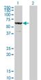 Chaperonin Containing TCP1 Subunit 8 Like 2 antibody, H00150160-M12, Novus Biologicals, Western Blot image 