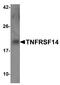 TNF Receptor Superfamily Member 14 antibody, A02298-1, Boster Biological Technology, Western Blot image 