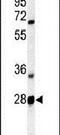 Receptor Transporter Protein 2 antibody, PA5-24995, Invitrogen Antibodies, Western Blot image 