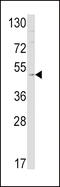 Endothelin Receptor Type B antibody, 62-464, ProSci, Western Blot image 