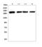 Zinc Finger E-Box Binding Homeobox 1 antibody, A00548-2, Boster Biological Technology, Western Blot image 