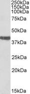Troponin T2, Cardiac Type antibody, EB11810, Everest Biotech, Western Blot image 