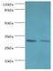 Chloride Intracellular Channel 4 antibody, MBS1497078, MyBioSource, Western Blot image 