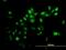 Tripartite Motif Containing 39 antibody, H00056658-B02P, Novus Biologicals, Immunofluorescence image 