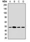 Acyl-CoA Dehydrogenase Long Chain antibody, LS-C667681, Lifespan Biosciences, Western Blot image 