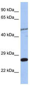 MIS12 Kinetochore Complex Component antibody, TA344385, Origene, Western Blot image 