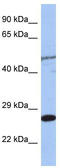 Protein MIS12 homolog antibody, TA344385, Origene, Western Blot image 