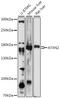 Ataxin 2 antibody, 16-703, ProSci, Western Blot image 